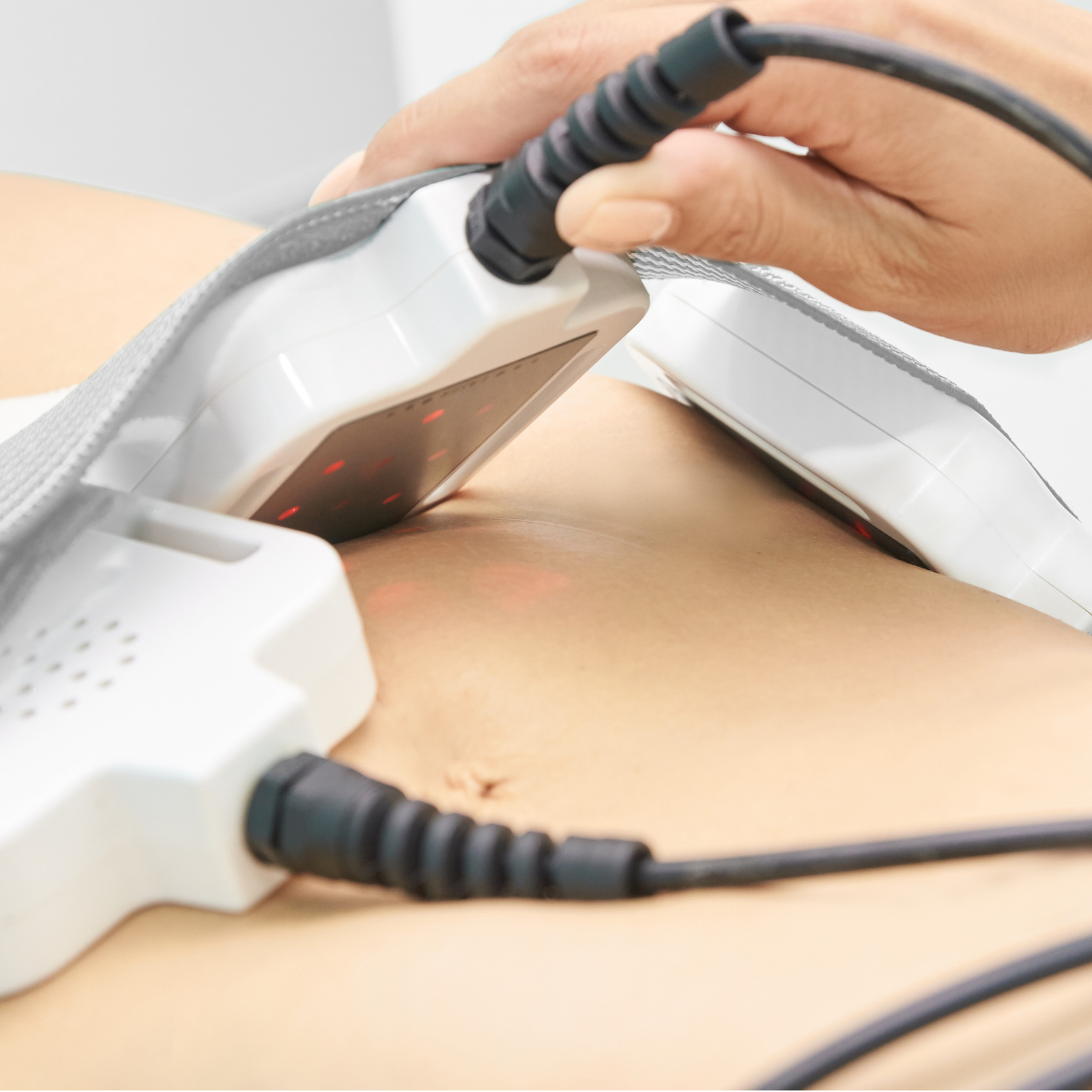 Read more about the article علاج تكيسات المبايض بالرياض: دليل شامل من التشخيص إلى التعافي في مجمع العوالي الطبي