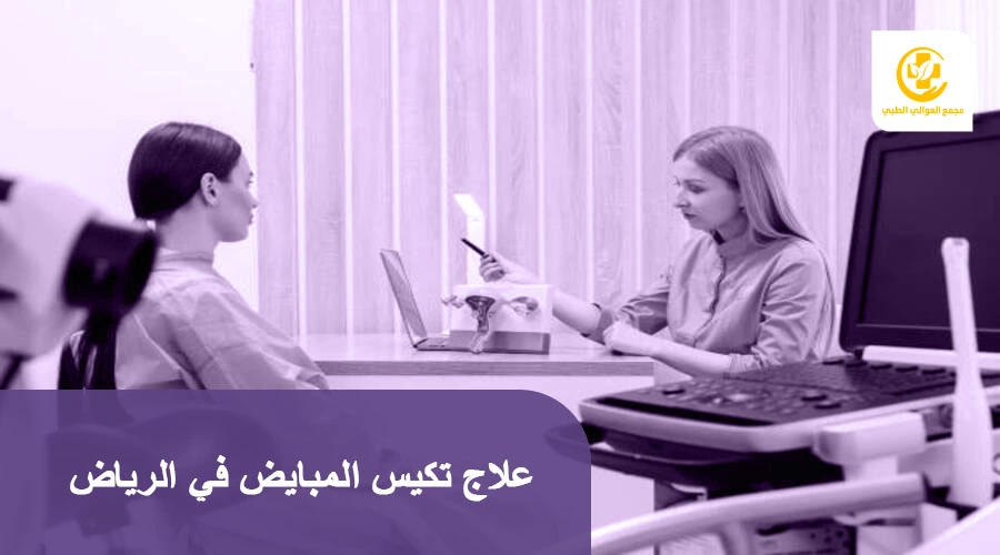 علاج تكيس المبايض في الرياض