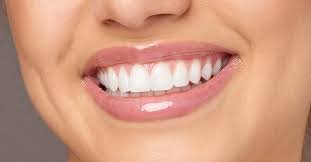 You are currently viewing ابتسامة هوليود في افضل عيادة اسنان بالرياض