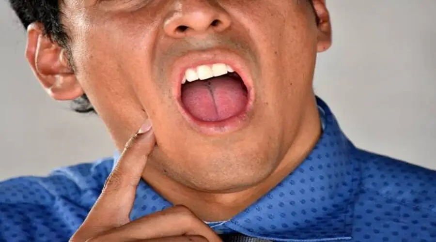 ماسبب فطريات الفم؟ وأهم العوامل اللي بتسببها طرق الوقاية من فطريات الفم