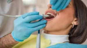 Read more about the article اسعار تنظيف وتبييض الأسنان: دليلك الكامل للحصول على ابتسامة